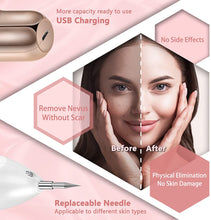 Load image into Gallery viewer, Skin Tag Remover Fibroblast Plasma Pen Skin Tag Removal Kit Tools with Home Usage USB Charging