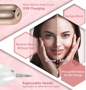 Skin Tag Remover Fibroblast Plasma Pen Skin Tag Removal Kit Tools with Home Usage USB Charging